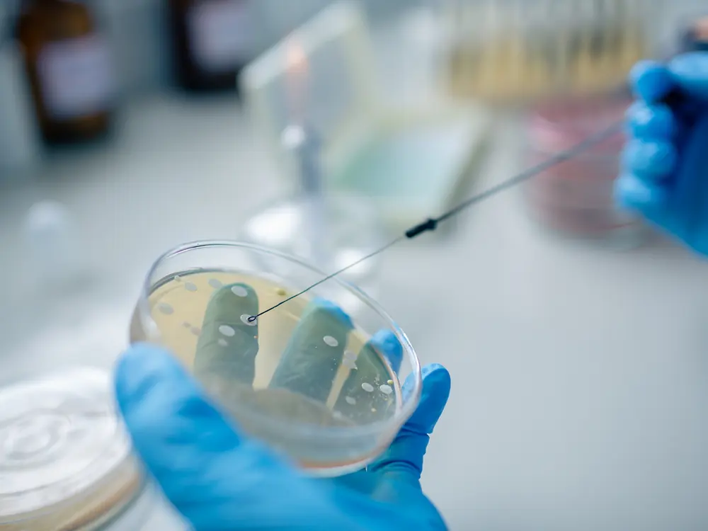 Gehandschoende hand met een entnaald boven een petrischaal met bacteriekolonies