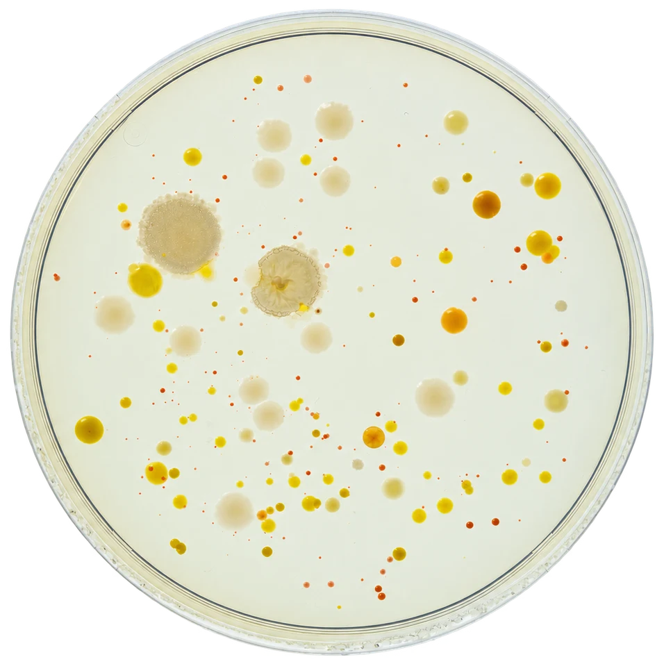 Bacterial colonies on agar in a petri dish